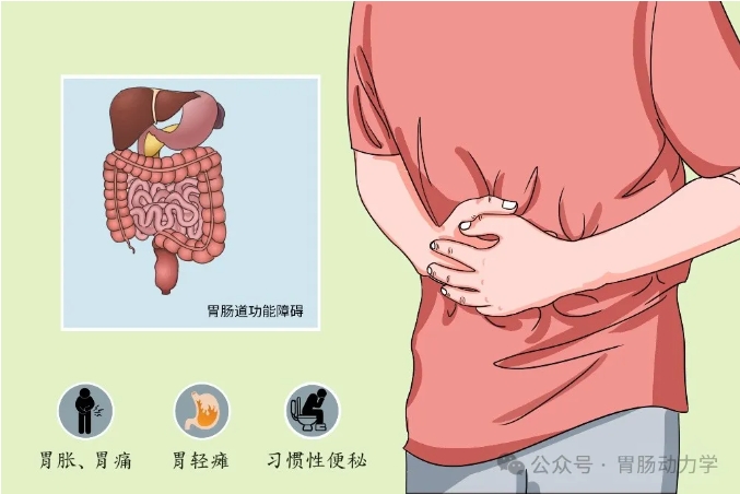 胃動力治療儀 胃動力治療儀