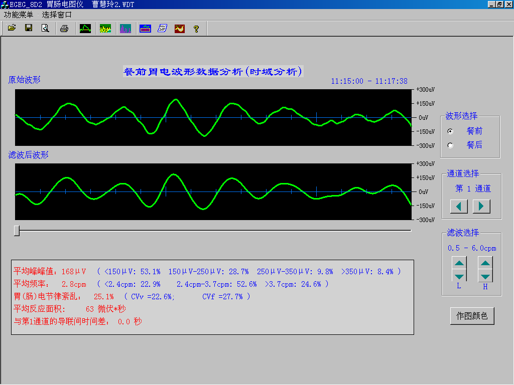 EGEG-8D八導(dǎo)胃腸電圖儀(圖1) EGEG-8D八導(dǎo)胃腸電圖儀(圖1)