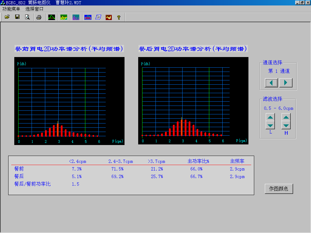 EGEG-8D八導(dǎo)胃腸電圖儀(圖2) EGEG-8D八導(dǎo)胃腸電圖儀(圖2)