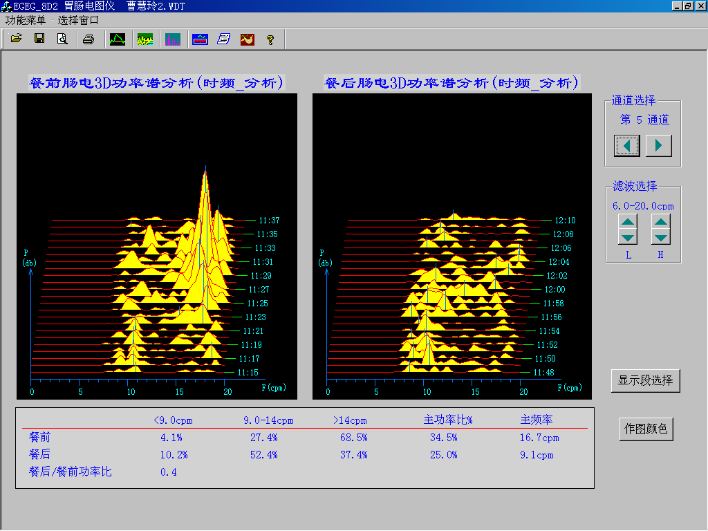 EGEG-8D八導(dǎo)胃腸電圖儀(圖3) EGEG-8D八導(dǎo)胃腸電圖儀(圖3)