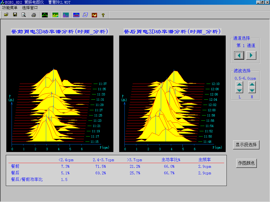 EGEG-8D八導(dǎo)胃腸電圖儀(圖4) EGEG-8D八導(dǎo)胃腸電圖儀(圖4)