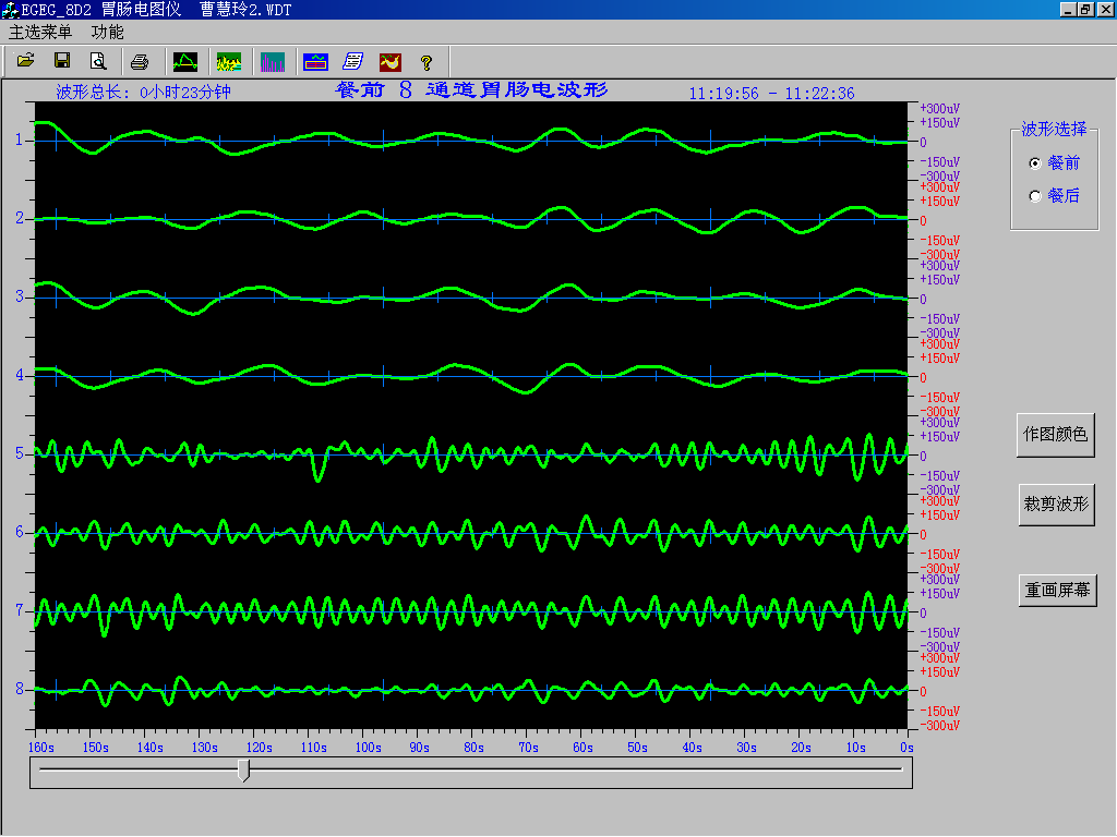 EGEG-8D八導(dǎo)胃腸電圖儀(圖5) EGEG-8D八導(dǎo)胃腸電圖儀(圖5)